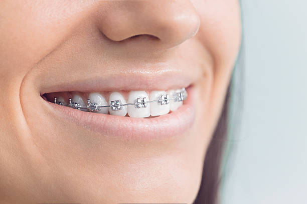 Best Teeth Whitening  in Rock Island, IL